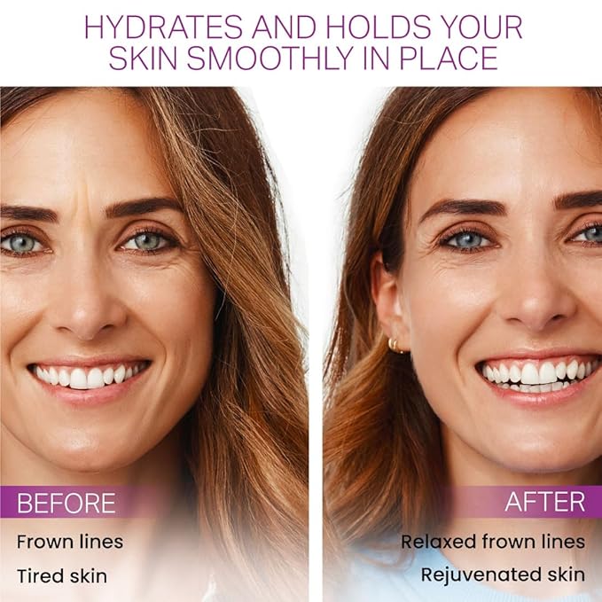 Furlesse Elevens Wrinkle Patches, Overnight Wrinkle Patches for Frown Lines, Non-Invasive Anti-Wrinkle Patches, Anti-Aging Skincare, 30 Patches, 30-Day Use-Velvo Beauty