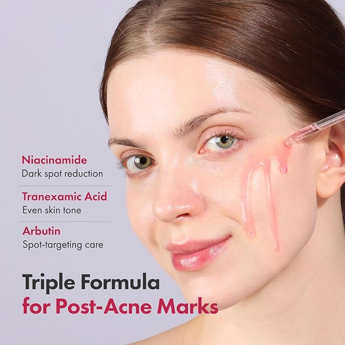 Niacinamide 10% + Tranexamic Acid 4% Serum, Arbutin 2%, Hyaluronic Acid, TXA Facial Serum, Glass Skin, Clarifying, Radiant Complexion with Natural Color, Korean Skin care, 33ml, 1.11 fl.oz.-Velvo Beauty