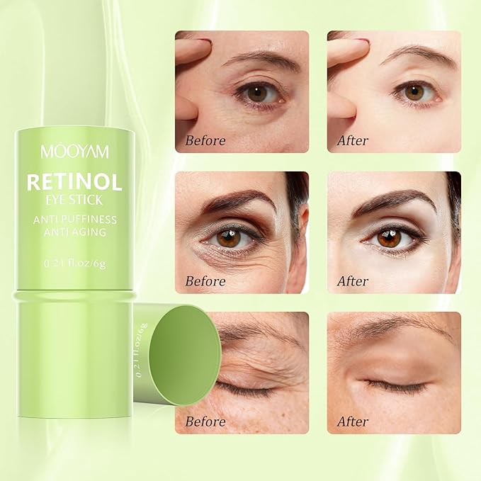 Retinol Eye Cream Brightening Eye Stick Anti-aging Eye Cream for Dark Circles and Puffiness Dark Circles Under Eye Treatment Under Eye Cream Puffy Eyes Treatment Firm Eye Bags Treatment for Men Women-Velvo Beauty
