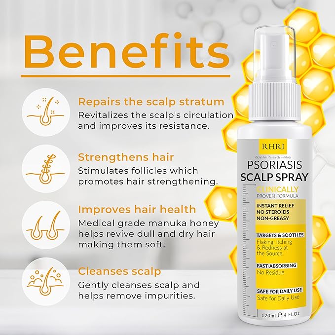 Psoriasis Scalp Spray | Psoriasis and Dandruff Treatment for Scalp Yeast Infections, Psoriasis Flare-Ups & Folliculitis | Antifungal Ringworm Itchy Scalp Spray for Psoriasis, Dryness-Velvo Beauty