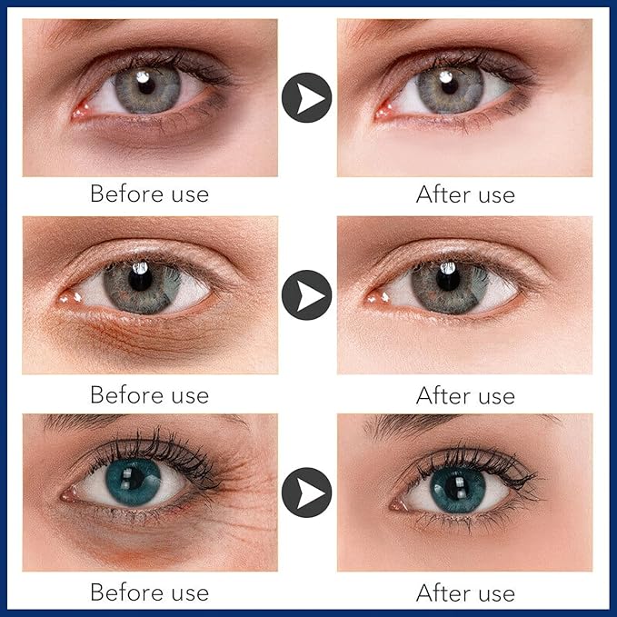Under Eye Cream for Dark Circles and Fine Lines, Repair Eye Cream for Lifting Firming and Anti-Wrinkle, Anti Age Eye Care Product-Velvo Beauty