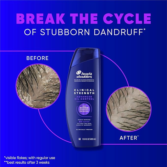 Head & Shoulders Clinical Dandruff Shampoo Twin Pack, Prescription Strength, Oil & Flake Control, Seborrheic Dermatitis Relief, Citrus, 13.5 Fl Oz Each (Set of 2)-Velvo Beauty