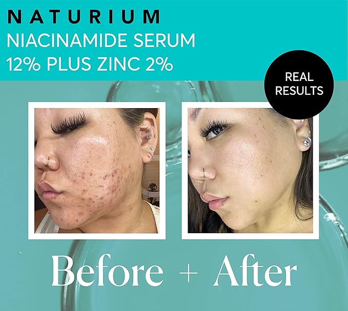 Naturium Niacinamide Face Serum 12% Plus Zinc 2% Jumbo, Anti-Aging, Pore Minimizer & Dark Spot Corrector with Hyaluronic Acid & Vitamin E, Vegan & Cruelty-Free, 2 oz-Velvo Beauty
