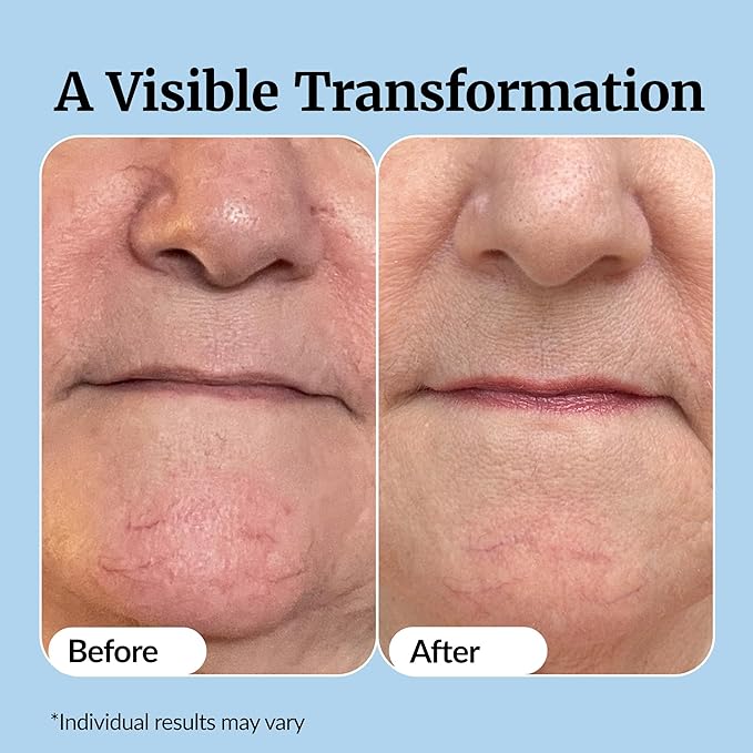 Vibriance Super C Serum for Mature Skin - All-in-One Vitamin Formula Hydrates, Firms, Lifts, Smooths, Targets Age Spots, Wrinkles, 1 fl oz-Velvo Beauty