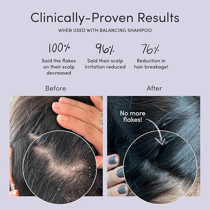 Jupiter, Physician-Formulated Scalp Balancing Conditioner for Dry, Itchy, Oily, Flaky Scalp, Sulfate-Free, Natural Fragrance, Vegan, Color-Safe, & Paraben-Free Conditioner for Women & Men-Velvo Beauty