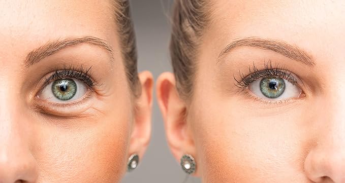 Anti Aging Eye Cream, Bright Eyes, Daily Wrinkle Cream for Firming, Dark Circles, Puffiness-Velvo Beauty