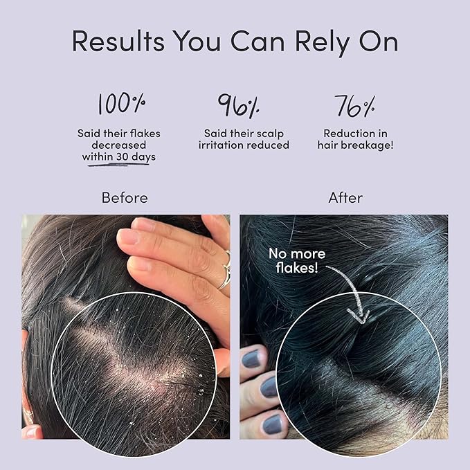 Jupiter Oil Control & Exfoliation Bundle, Anti-Dandruff Shampoo, Conditioner, Restoring Serum, & Purifying Mask for Women & Men, Dermatologist-Formulated for Flaky, Itchy, Oily, & Dry Scalp-Velvo Beauty