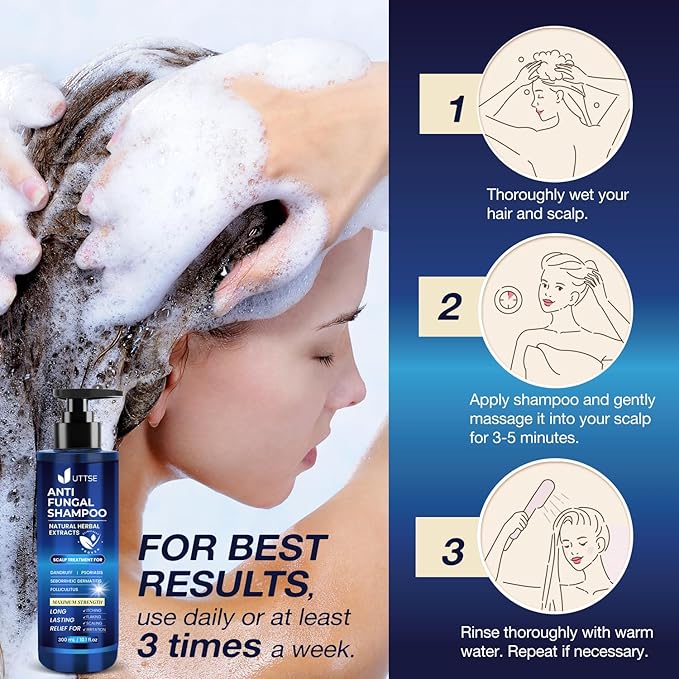 Anti-Fungal Shampoo for Scalp Psoriasis: Dandruff Shampoo for Folliculitis and Seborrheic Dermatitis - Relieves Itchy & Dry Scalp - 300 mL / 10.1 fl.oz-Velvo Beauty