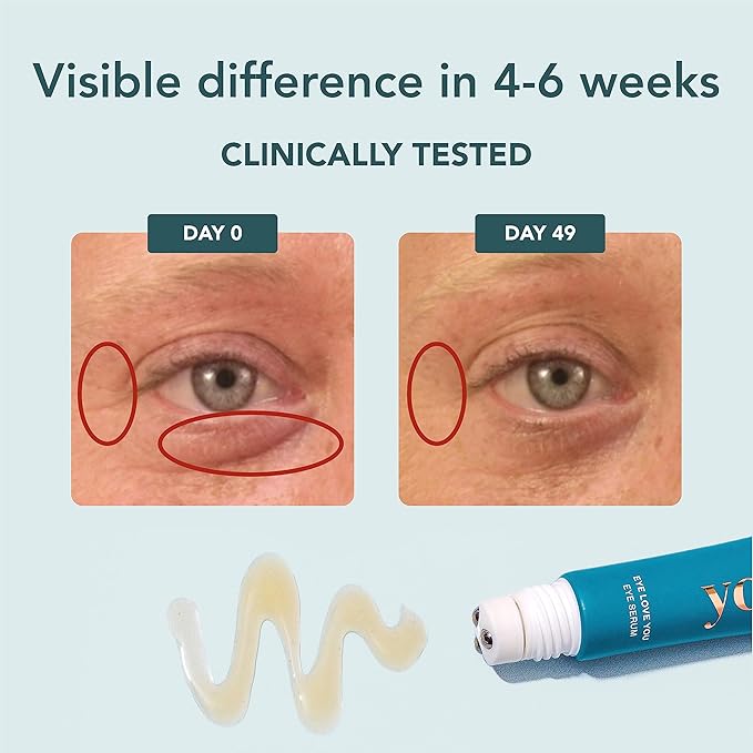 YOURS Eye Serum with Caffeine & Antioxidants | Hydrates and Brightens Under Eye Area | Restores Skin Firmness and Reduces Appearance of Fine Lines-Velvo Beauty