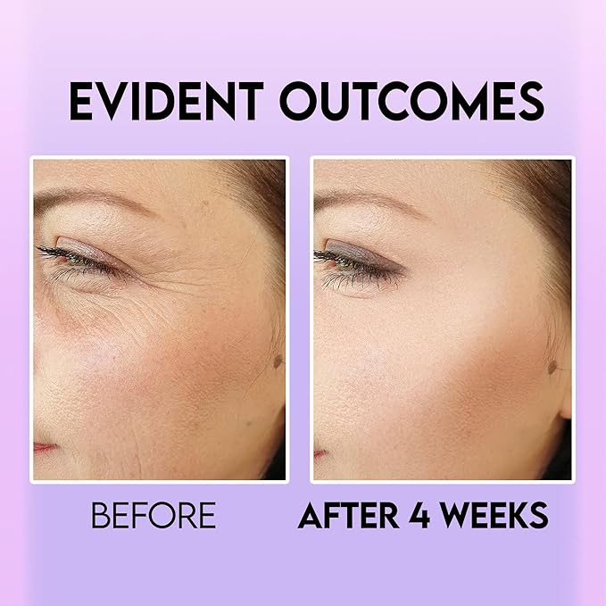 Eye Bag Remover, Under Eye Dark Circle Remover with Retinol & Caffeine, Under Eye Brightener, Anti Aging Eye Tightening Cream to Repair Wrinkles and Fine Lines-Velvo Beauty