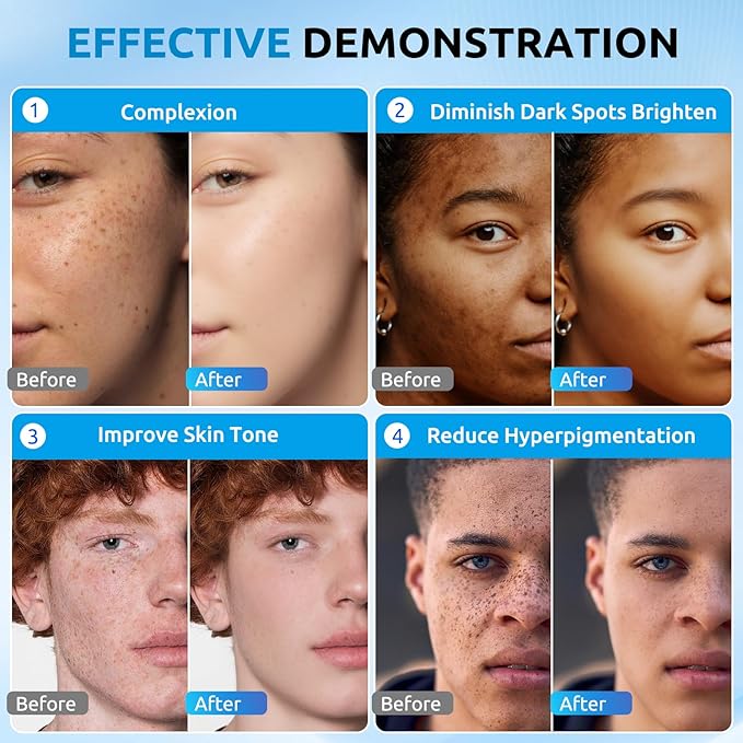 HANYWIL Dark Spot Corrector Cream for Hyperpigmentation,Brightening Serum for Face & Body,Rapid Fade Treatment for Sun Spots, Age Spots & Melasma,Dermatologist-Tested Skin Tone Evenser (2.0 Fl Oz)-Velvo Beauty