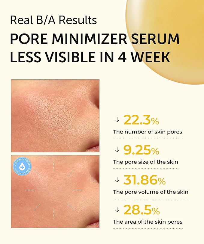SERUMKIND Pore tightening and Refining Serum Korean Face Skincare - Natural Salicylic acid - Yellowmello Extract 92% -1 fl.oz.-Velvo Beauty