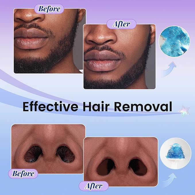 Nose Wax Kit for Men Nose Waxing, 100g Wax 30 Applicators Ear wax kit Hair Removal for Men and Women,Safe Quick Painless Nasal Waxing,10 Mustache Patch 10 Ears Guards,15-20 Uses-Velvo Beauty