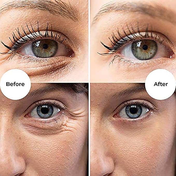 Gle Vitamin C Eye Serum for Dark Circles, Eye Wrinkles, Redness and Puffy Eyes | Anti-Aging Treatment with Caffeine, Vitamin C Hyaluronic Acid | Hydrating & Brightening Scent-Free | (Pack of 2)-Velvo Beauty
