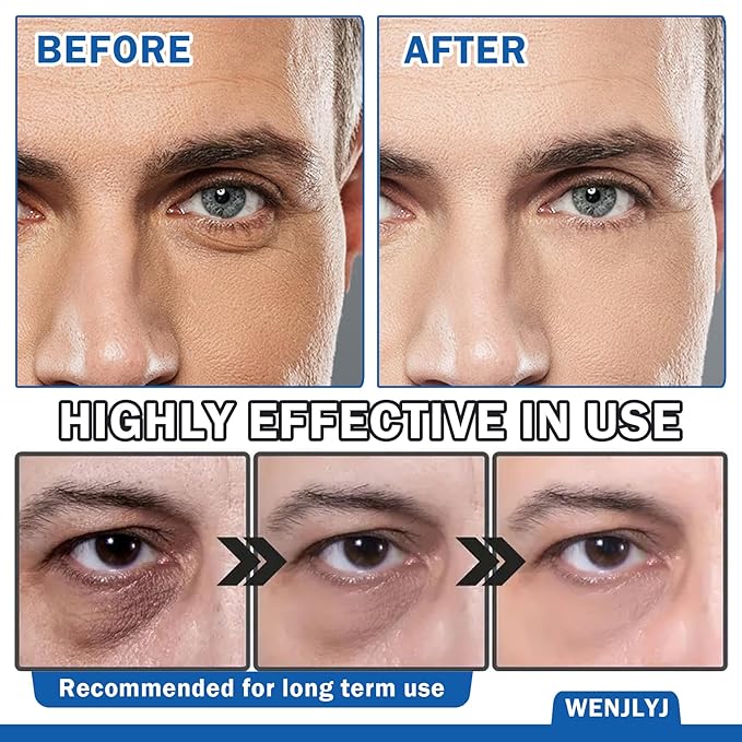 Men's Eye Cream,Hydrating Eye Cream for Men,Smooth Under Eye Cream for Dark Circles and Puffiness,Moisturizing Eye Cream Reduce Wrinkles Fine Lines & Firm Skin-Velvo Beauty