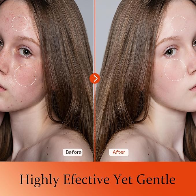 Vitamin C Serum For Face-Anti Aging & Wrinkle Facial Serum With Vitamin C,Sodium Hyaluronate,Vitamin E And More,Skin Brightening Serum For Dark Spots,Fine Lines & Dull Skin,1 Fl Oz-Velvo Beauty