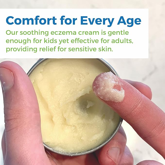 Waxhead Aftersun Body Butter for Sunburn Relief - Also great Tattoo Balm, Eczema Cream for Kids Adults, After Sun Lotion, Sunburn Treatment, Healing Salve-Velvo Beauty