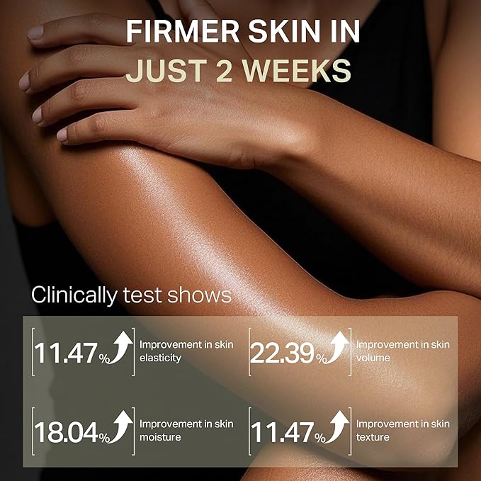Ultra-Size Firming Retinol Body Lotion for Crepey Skin & Keratosis Pilaris with 0.05% Retinol, AHA, Collagen, Body Cream, Anti Aging Moisturizer 10.14 fl oz-Velvo Beauty