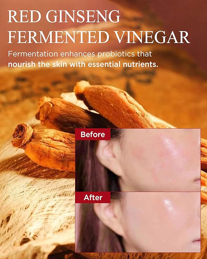 Bonyongo Red Ginseng Vinegar Essence– Revitalizing & Intensive Nourishing for All Skin Types - Hydrated and Glowing Skin with Fermented Red Ginseng - Korean Skincare, 1.5 fl.oz.-Velvo Beauty