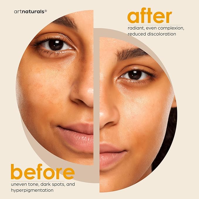 Kojic Acid Soap + African Net Sponge (2 pack X 142g Turmeric bars) Dark spot remover & Scars - Original Japanese Complex Vitamin C, Hyaluronic Acid, retinol, shea butter (Citrus)-Velvo Beauty