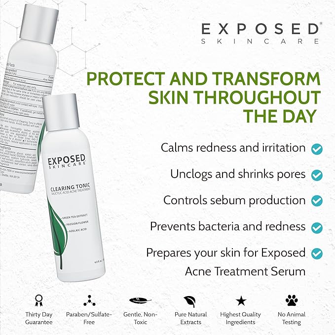 Exposed Skin Care Clearing Tonic Facial Toner with 1% Salicylic Acid and Witch Hazel for Acne Treatment – Pore Minimizing Toner to Prevent Breakouts, Reduce Redness and Balance Skin – Step 2 (4 fl oz)-Velvo Beauty
