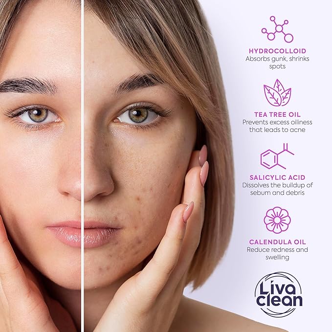 LivaClean 330 CT Pimple Patches for Face w/Salicylic Acid, Tea Tree Oil & Calendula Oil - Four Sizes - Pimple Patch, Hydrocolloid Patch, Acne Patches for Face-Velvo Beauty