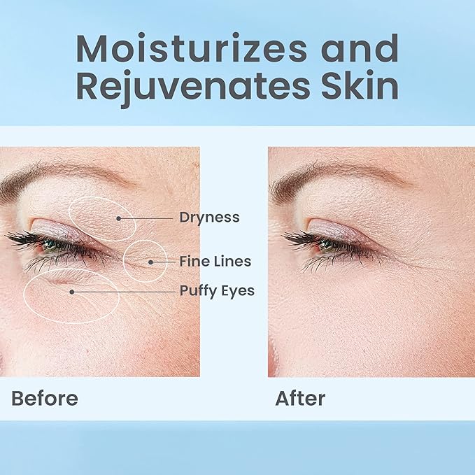 Hydrate& Replenish EYE CREAM- Gel Hydrator-Cream with Hyaluronic Acid & Marine Extracts, attracts moisture to the skin Algae And Seaweed Extracts to revitalize dull looking skin 0.5 Oz-Velvo Beauty