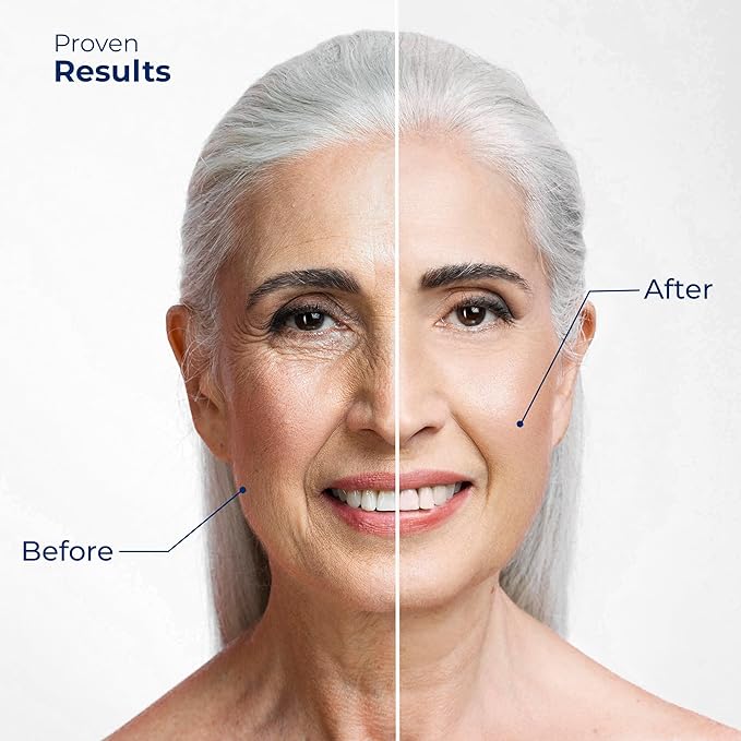 Retinol Eye Cream for Puffiness and Bags Under Eyes | Anti-Aging, Wrinkles & Fine Lines Treatment | Eye Cream for Wrinkles w/Advanced Tightening & Firming Formula | Eye Cream Anti Aging-Velvo Beauty