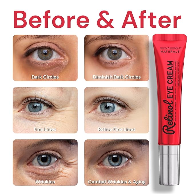 Retinol Under Eye Cream for Dark Circles & Puffiness, Daily Wrinkle Cream, Anti Aging Line Smoothing Skin Care Treatment for Women and Men, 1.7 fl. oz-Velvo Beauty