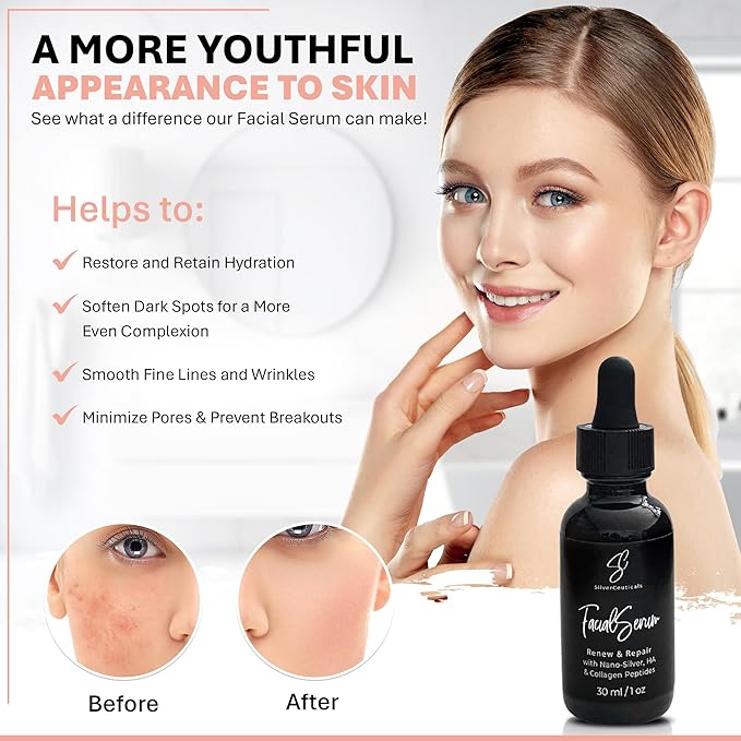 Facial Serum - Fight Blemishes - Acne Pimples & Breakouts - Soften Fine Lines & Wrinkles - Hydrate & Repair Damaged Skin - Clear Complexion - Collagen - 2 Types of Hyaluronic Acid - Anti Aging - 1oz-Velvo Beauty