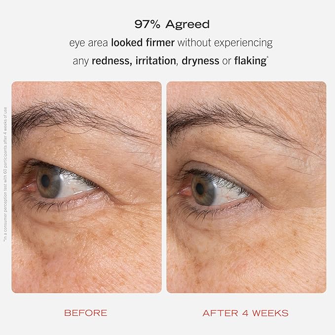 First Aid Beauty Retinol Eye Cream with Squalane + Ceramides – Visibly Smooths Fine Line & Wrinkles Around the Eyes – 0.5 oz.-Velvo Beauty