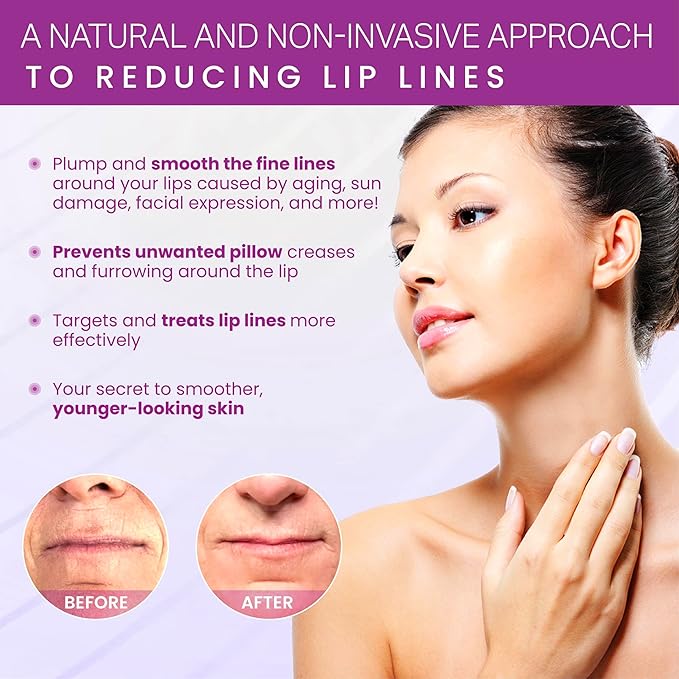 Furlesse Lip-Sticks Wrinkle Patches, Overnight Anti-Wrinkle Patches for Smile Lines, Fine Lines, and Expression Lines, Non-invasive Lip Patches, Anti-aging Skincare, 120 Patches, 30-Day Use-Velvo Beauty