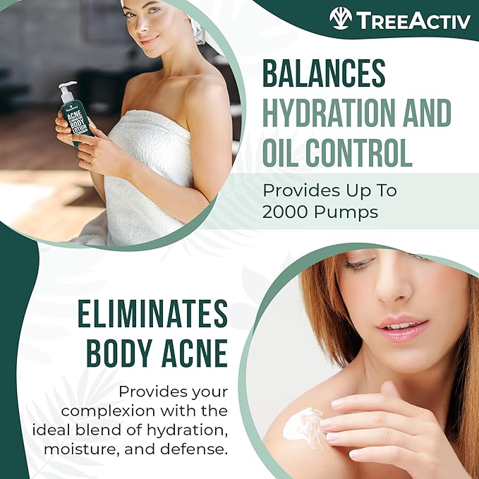 TreeActiv Acne Eliminating Body Lotion 8 fl oz | Clears Body, Back, Butt and Shoulder Acne | Anti-Acne Moisturizer | Prevents Future Breakouts | Cucumber Mint Scent-Velvo Beauty