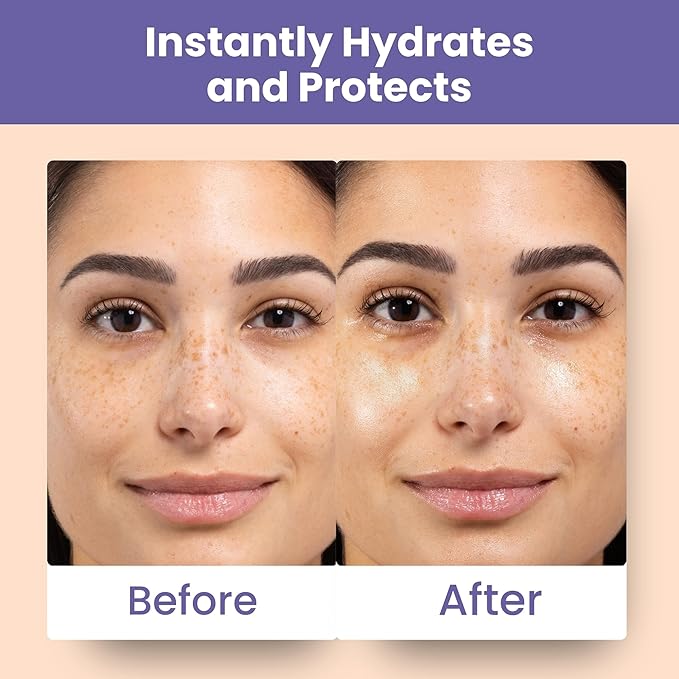 Patchology Skin Remedy Calm & Protect Micro Mist – Hydrating Facial Spray with Ectoin, Probiotics & Botanical Blend - Fragrance Free - Refines Pores & Leaves a Fresh Glow - 80 mL-Velvo Beauty