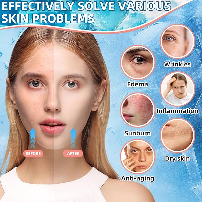 Silicone Facial Ice Cube Roller Massager, Facial Beauty Care Tool, Reusable Face Ice Mold - Brighten Skin, Reduce Puffiness for Face & Eyes (Black)-Velvo Beauty