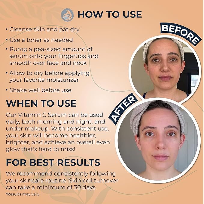 Vitamin C Face Serum - Anti Aging & Brightening Facial Serum - With Hyaluronic Acid Gotu Kola & Jojoba Oil - Natural & Organic - Foxbrim Naturals 1oz-Velvo Beauty