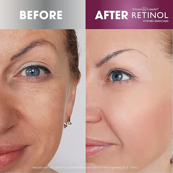 Retinol Super Face Lift - Visibly firms and tightens for a lifted, younger look. Infused, Vitamins C & E, this firming blend is a beauty “quick-fix”-Velvo Beauty