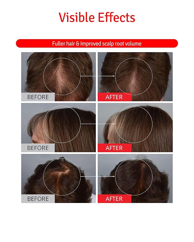 Scalp+ Shampoo for DHT Blocker, Hair Loss Relief - Moisture Anti-Aging Thickening Volumizing Fortifying & Repairing Hair Strength Fuller Hair with Vitamin C, Peptides, Biotin, 10.14 fl.oz.-Velvo Beauty