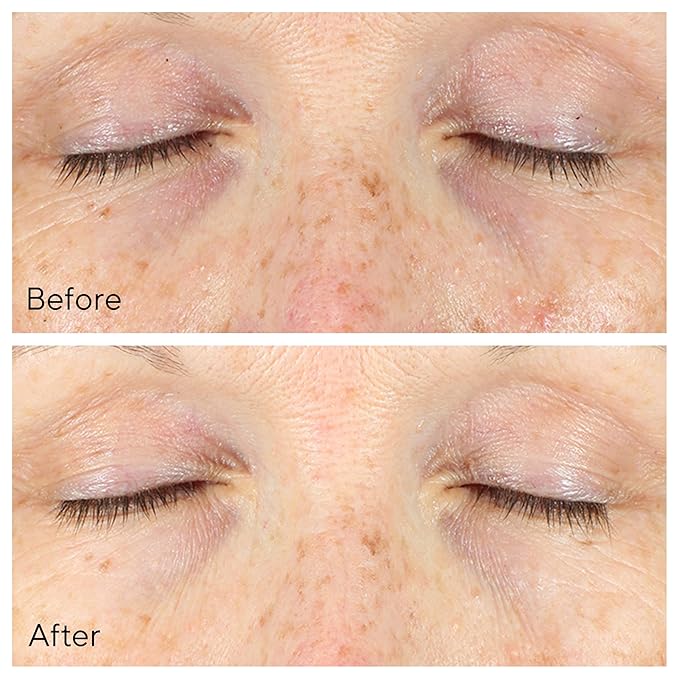 Murad Vita-C Eyes Dark Circle Corrector – Environmental Shield Vitamin C Brightening Serum – Anti-Aging Treatment for Puffiness and Wrinkles, 0.5 Fl Oz-Velvo Beauty