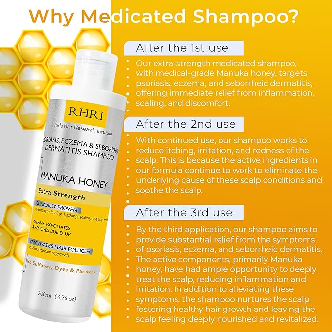Psoriasis Shampoo for Men & Women | Itchy Scalp Treatment with Manuka Honey | Best for Eczema, Seborrheic Dermatitis, Ringworm & Folliculitis Scalp Treatment-Velvo Beauty