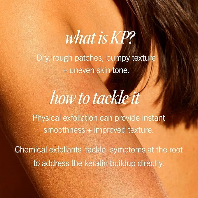 First Aid Beauty - KP Bump Eraser Body Scrub with 10% AHA, Keratosis Pilaris Exfoliator with Glycolic and Lactic acids, Helps Reduce Chicken Skin Bumps, Safe for Sensitive Skin, Strawberry Scent, 2 oz-Velvo Beauty