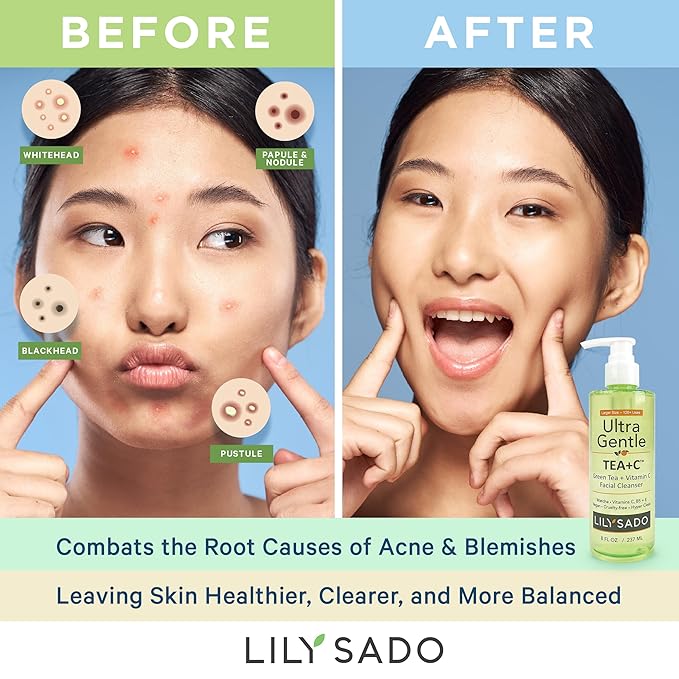 LILY SADO TEA+C™ Green Tea & Vitamin C Face Cleanser – Natural Vegan Antioxidant Daily Face Wash with Aloe, Rosehip, Meadowfoam - Gentle Deep Cleansing for Acne, Blackheads, Blemishes. 8 oz-Velvo Beauty