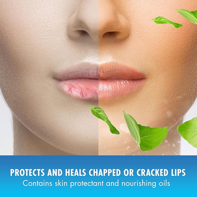 Mentholatum (R) Natural Ice (R) Sport Broad Spectrum SPF 30 Medicated Lip Balm - 12 Pack of 4.5 g Tubes-Velvo Beauty