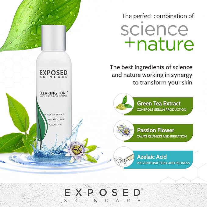 Exposed Skin Care Clearing Tonic Facial Toner with 1% Salicylic Acid and Witch Hazel for Acne Treatment – Pore Minimizing Toner to Prevent Breakouts, Reduce Redness and Balance Skin – Step 2 (4 fl oz)-Velvo Beauty