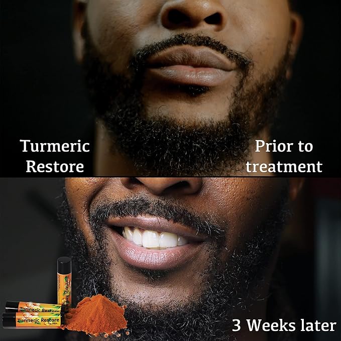 Turmeric Lip balm | Turmeric Restore | Natural Lip Balm | Organic Lip Balm | Natural Lip Balm | Lip Moisturizer | 100% Natural Ingredients | Habbie Beauty Supplies (6 Pack)-Velvo Beauty