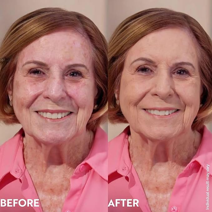 M. Asam Magic Finish Make-Up Mousse (1.01 Fl Oz) – 4in1 Primer, Foundation, Concealer & Powder With Buildable Coverage, Hides Redness And Dark Spots, Vegan, For Light To Medium Skin Tones-Velvo Beauty