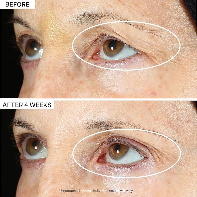 StriVectin Tighten & Lift Peptight 360 Degree Eye Serum with Tightening & Brightening Peptides for Wrinkles, Under Eye Bags and Puffiness, 1 fl. Oz-Velvo Beauty