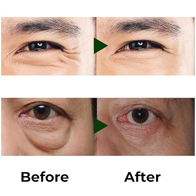 Abera Eye Roller Serum with Mint Essence, Vitamin C and Peptides - Energizing Serum for Dark Circles and Puffiness, Fine Lines Serum, 0.34 fl oz-Velvo Beauty