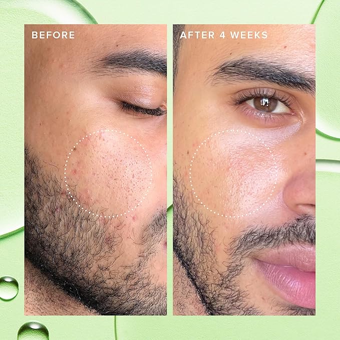 Farmacy 2% Salicylic Acid Toner for Face - Deep Sweep Gentle BHA Exfoliant for Oily Skin - Refines Texture with Papaya Enzymes & Moringa Water for a Healthy-Looking Complexion (100ml)-Velvo Beauty
