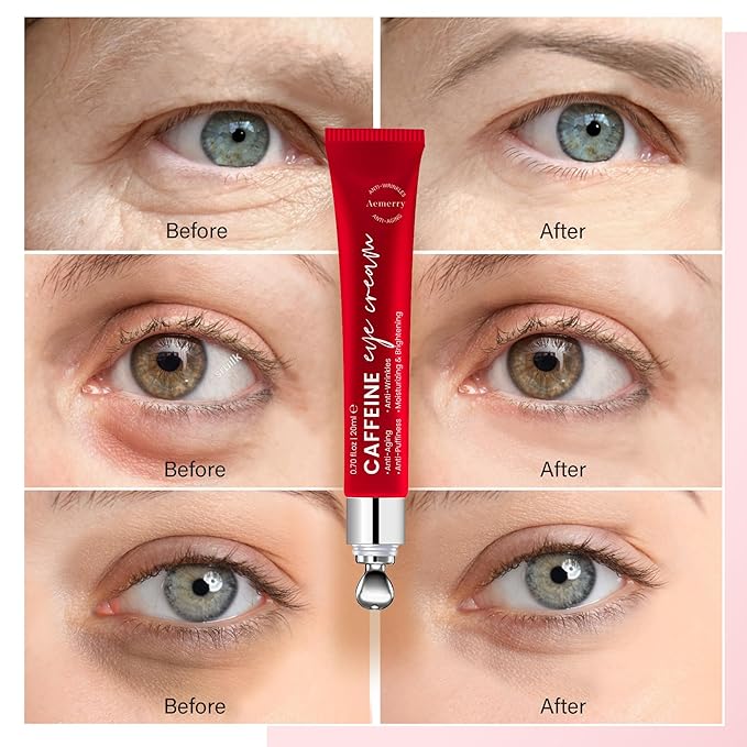 Caffeine Eye Cream Anti Aging: Eye Cream With Retinol, Sodium Hyaluronate, Vitamin E, For Dark Circles, Wrinkles, Puffiness & Fine Lines - Advanced Metal Applicator For Under Eye Bags And Puffy Eyes-Velvo Beauty